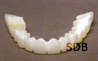Snap on smile Cosmetic Removable Partial Denture